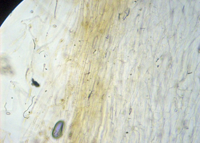 DSCN8432.JPG (150.29 Kio) Vu 3202 fois 1. Epicutis