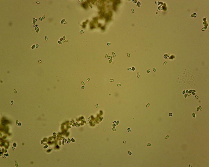 Spores 40 X  Melzer..jpg