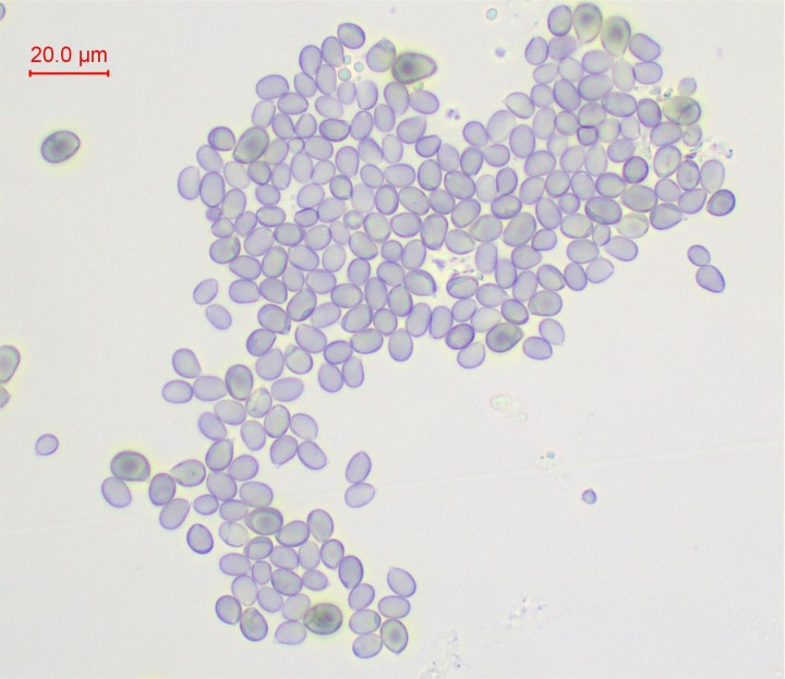 Spores prélevées sur une lame ; amyloïdes ; 9x7µ
