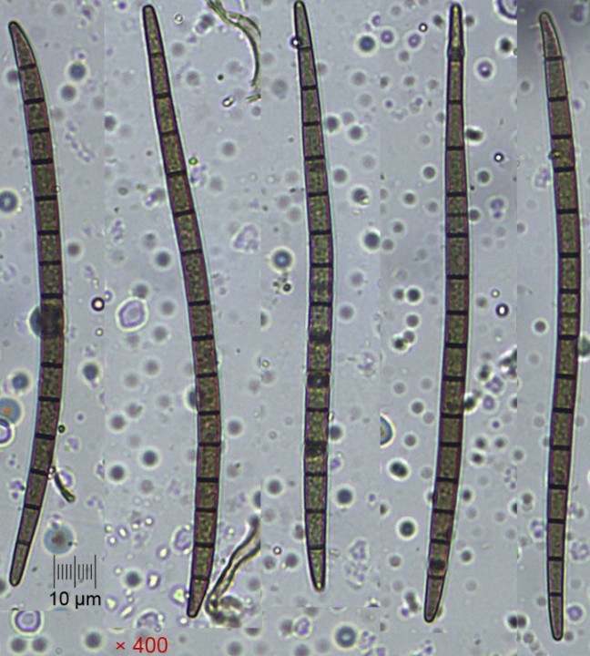 spores_x400_01.jpg