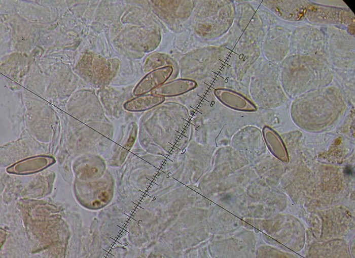 sphérocystes (cuticule) et spores