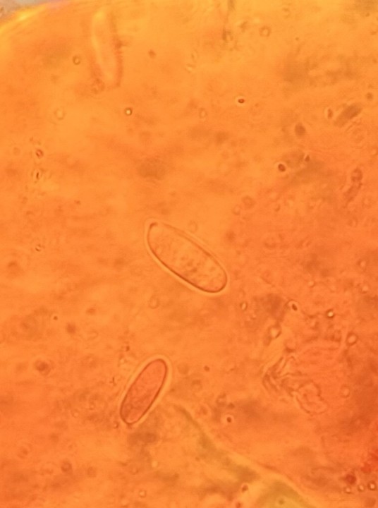 spores.jpg