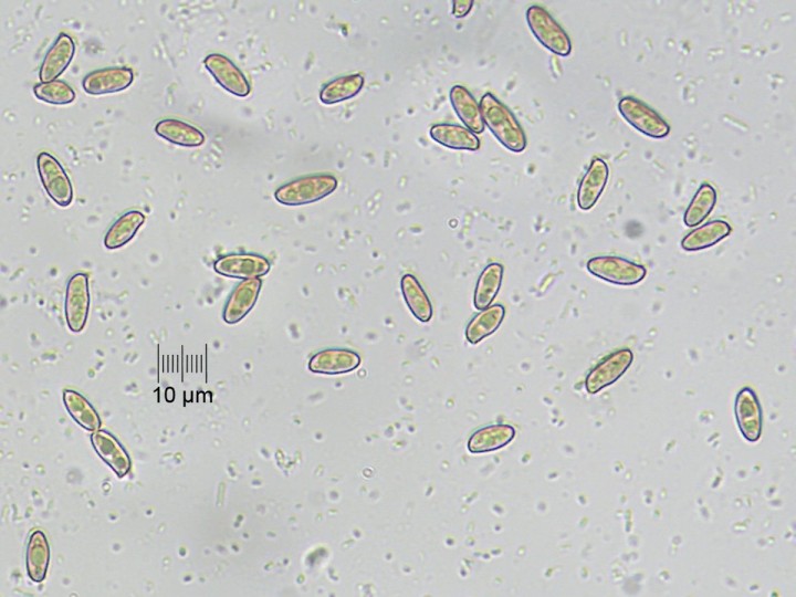 spores_x400.jpg