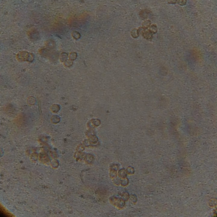 Rhodocybe type 241102 spore 04821.JPG