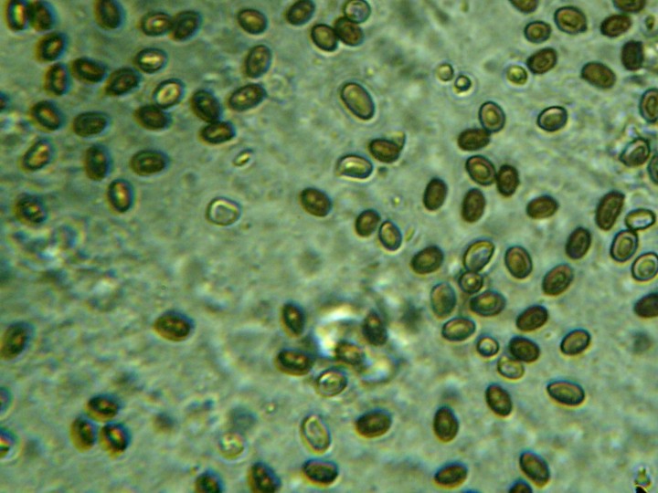 Spores prélevé (x400), mis dans une solution neutre.