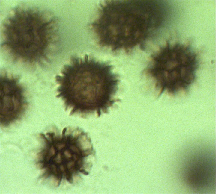 Microscopie Pierre Perillier