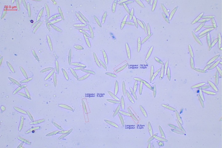 spores à l'éjection