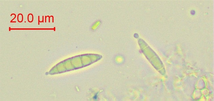 spores matures