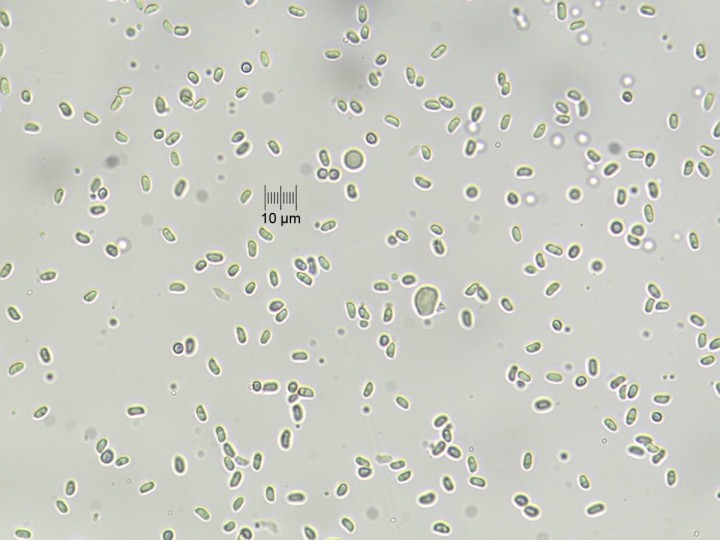 spores_x400_Meltzer_02.jpg
