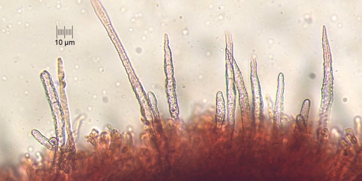 micro_x400_01.jpg