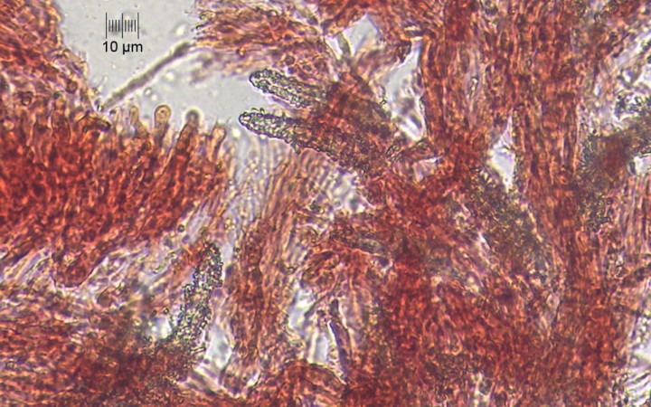 micro_x400_07.jpg