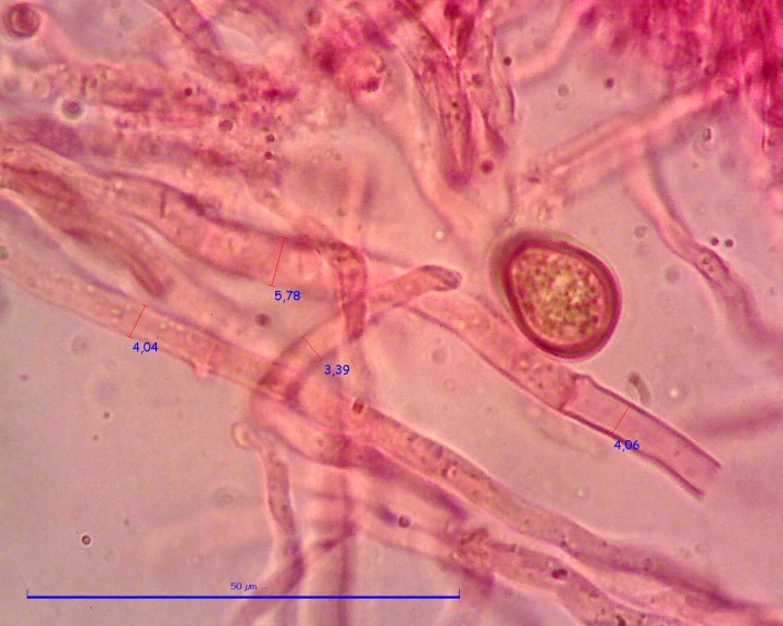 Sur Tamarix 100 X Hyphes (1).pixi.jpg