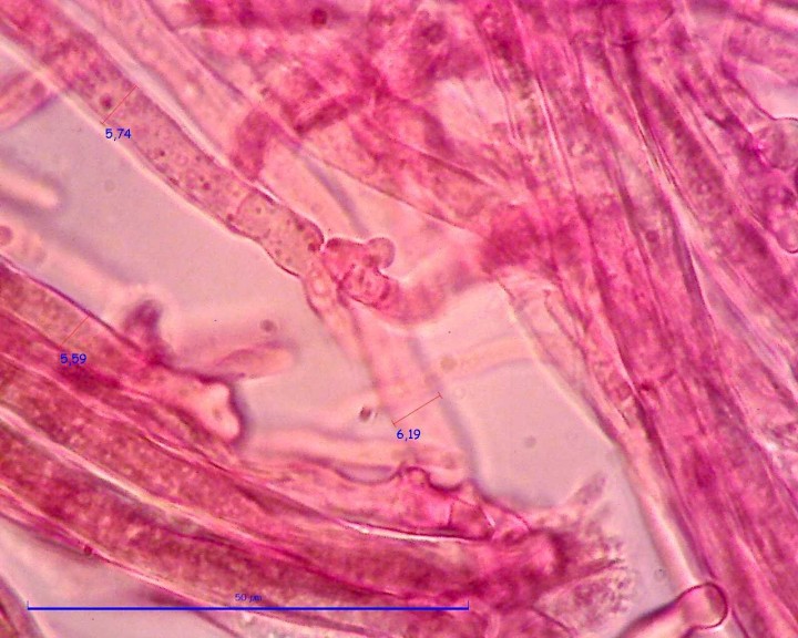Sur Tamarix 100 X Hyphes (5).pixi.jpg