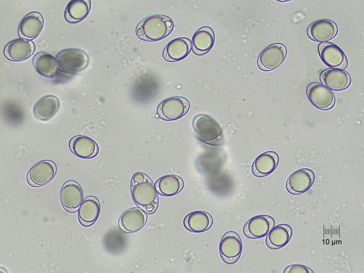 spores_x400.jpg
