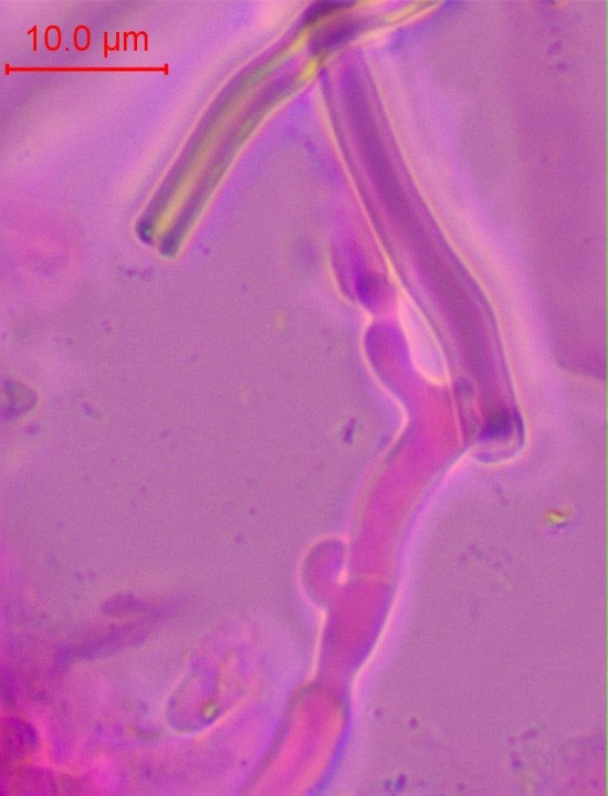 bcl-021.jpg (83.7 Kio) Vu 1022 fois hyphes génératrice et hyphe squelettique