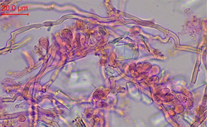 bsd-003.jpg (196.79 Kio) Vu 1022 fois Basides, hyphes génératrices et hyphes génératrices sclérifiées