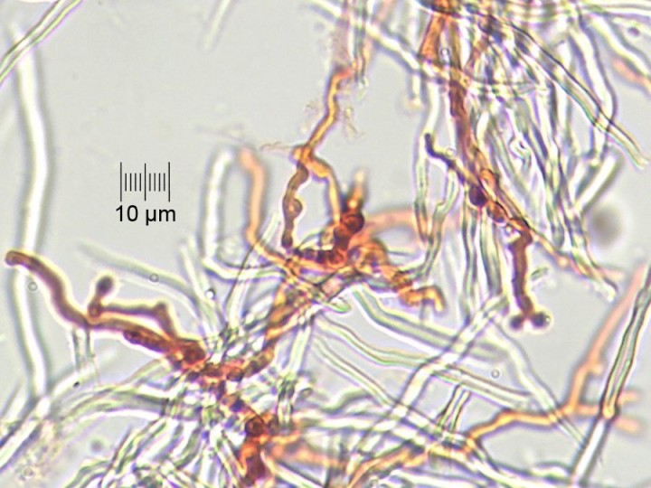 hyphes_x400_15.jpg