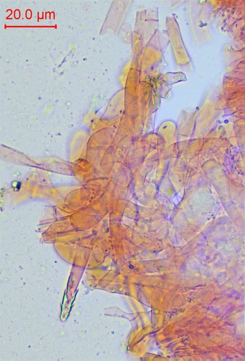 caulocystide