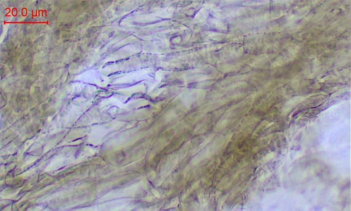 cutis-005.jpg