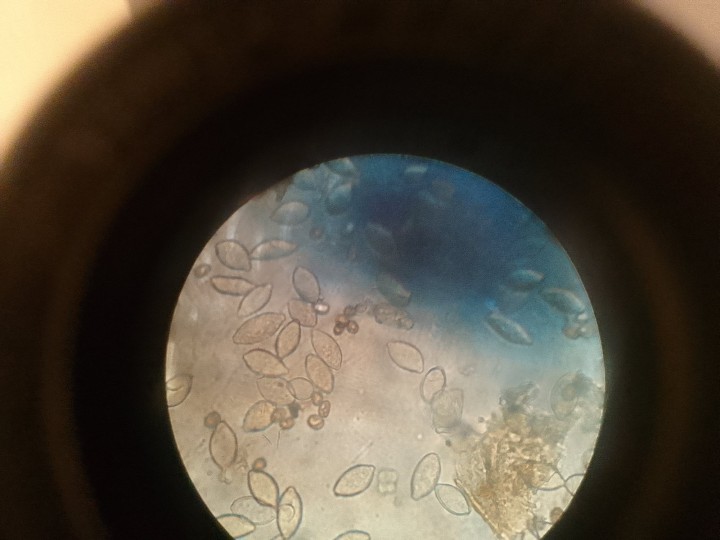 Spores avec témoins.
