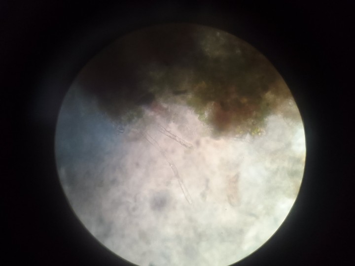 Cystides?