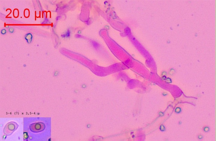 Cystide capitée et spores