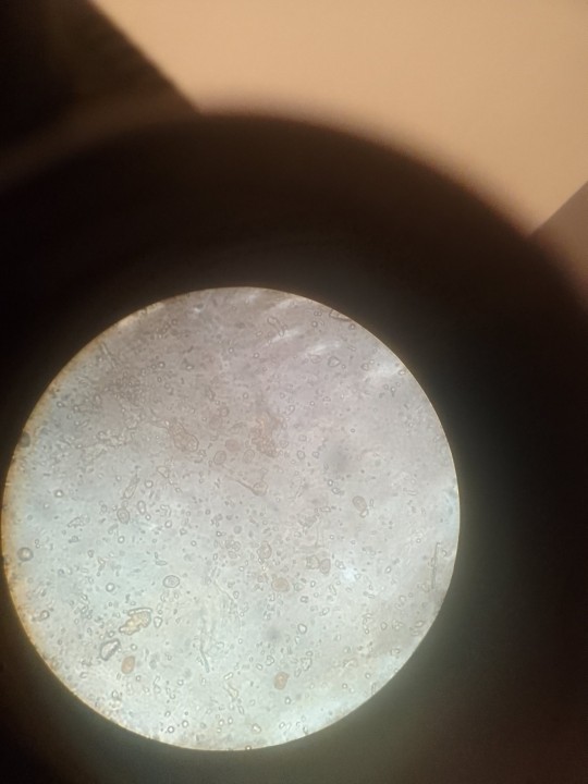 Soupe avec spores témoins