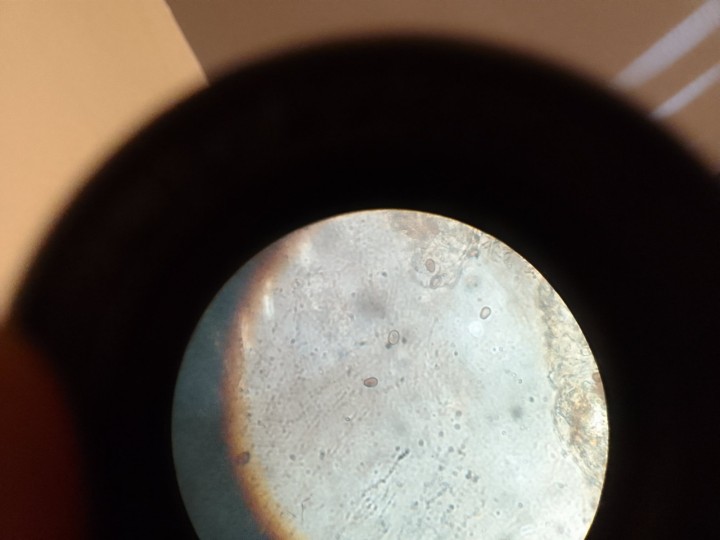 Spores et témoins.