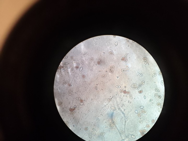 Spores et témoins d'A.bisporus
