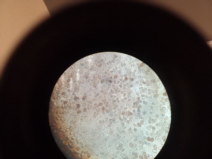 Spores avec témoins d'A.bisporus
