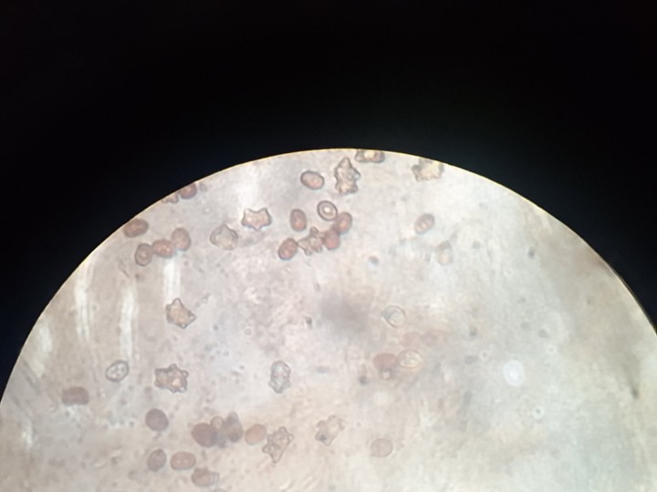 Spores avec témoins d'A. bisporus