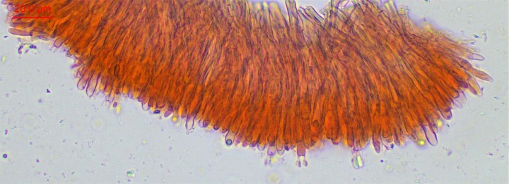 hymen-013.jpg