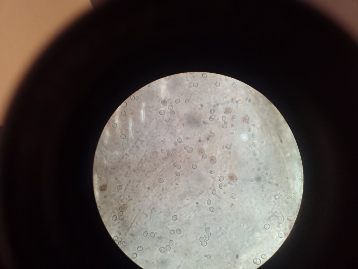 Spores x100