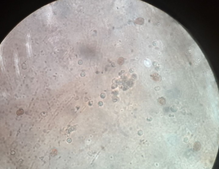 Spores et temoins