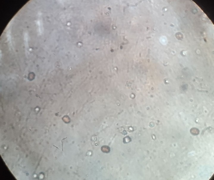 Spores et temoins (A.bisporus)