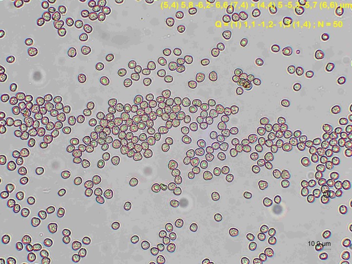 spores 1.jpg