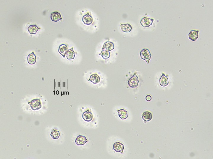 spores_x400.jpg
