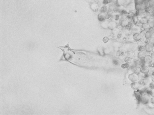 micro_070824_pluteus_tricus.JPG