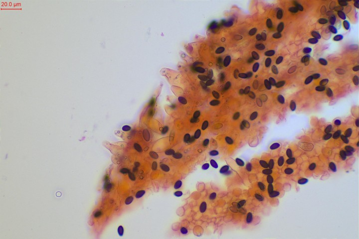 cf mucus-007.jpg