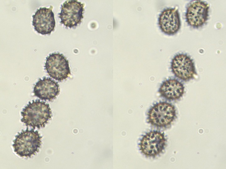 spores_x1000.jpg