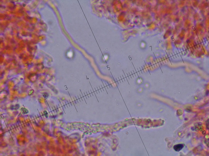 hyphes du dissépiment fortement incrustés