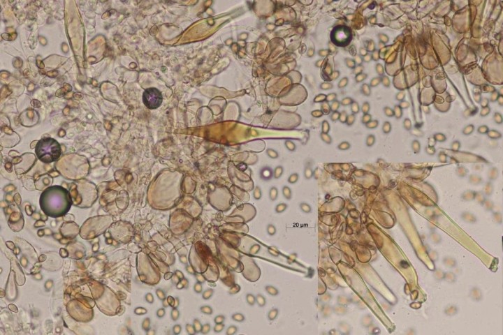 Inocybe jardin 2025.11.06_3 cystides RCA x 400 r.JPG