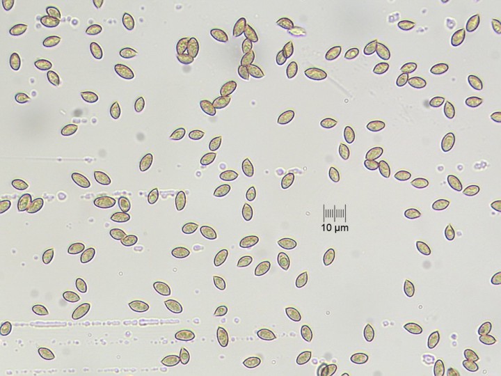 spores_x400_02.jpg