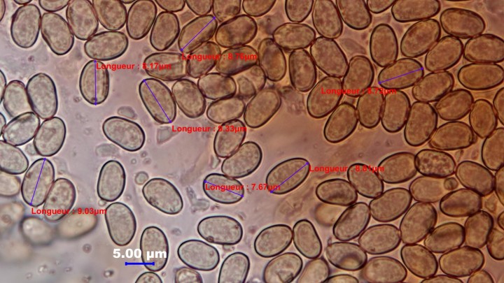 photo micro P Roux ref 5855- Spores 6154545403.jpg