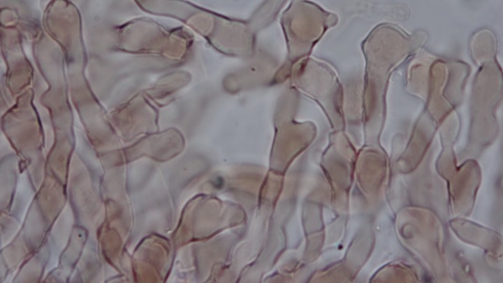 Cheilocystides diverticulées 5855-260226132850381.jpg