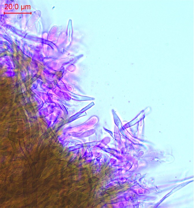 Cystides et basides de G. abietinum