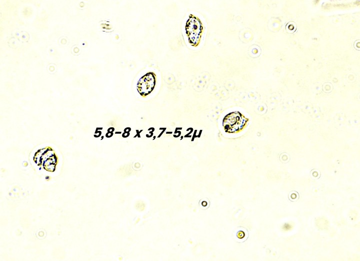 5,8-8 X 3,7-5,2µ 1.jpg