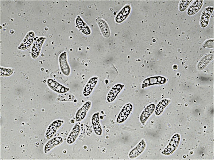 SPORES 9,5-13,6 x 3-4,5µ