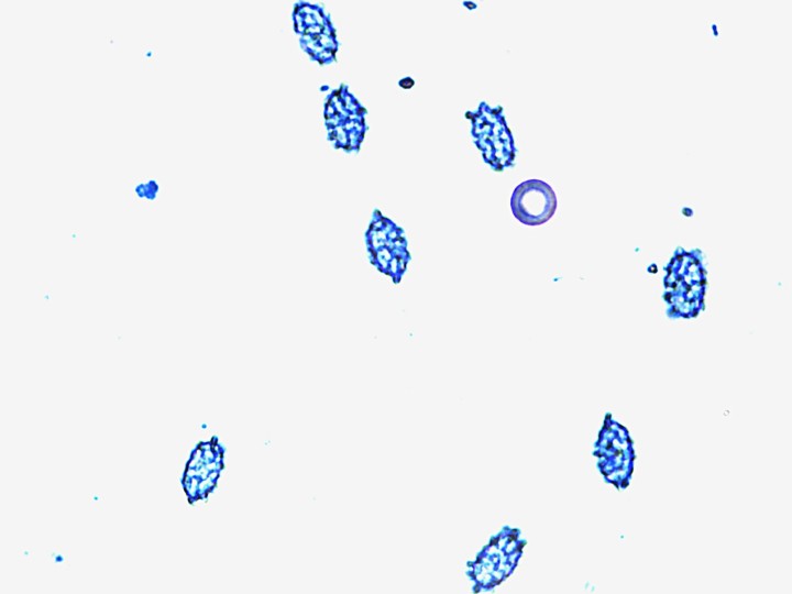 8,5-10,2- x 4,6-5.7µ.jpg