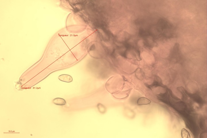 inocybe  Mt Courant cheilocystides-1.jpg